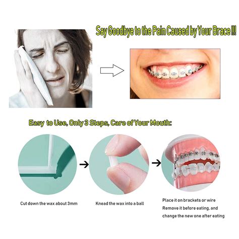 Orthodontic Wax For Braces Hrasy 10 Pack Dental Wax Brace Wearer Wax For Relieving Irritation