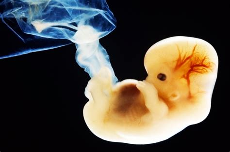 Científicos Buscan En Los Embriones Cómo Construir Nuevos órganos Los
