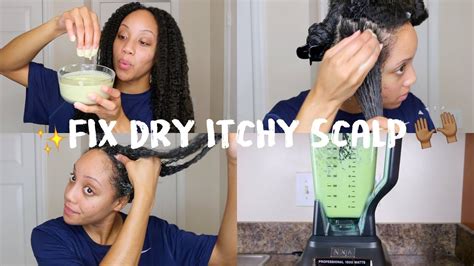 Diy Hair Mask For Dry Hair Get Rid Of Dry Itchy Scalp Youtube