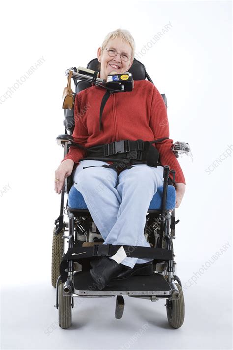 Portrait Of A Woman With Cerebral Palsy Stock Image C0467180 Science Photo Library