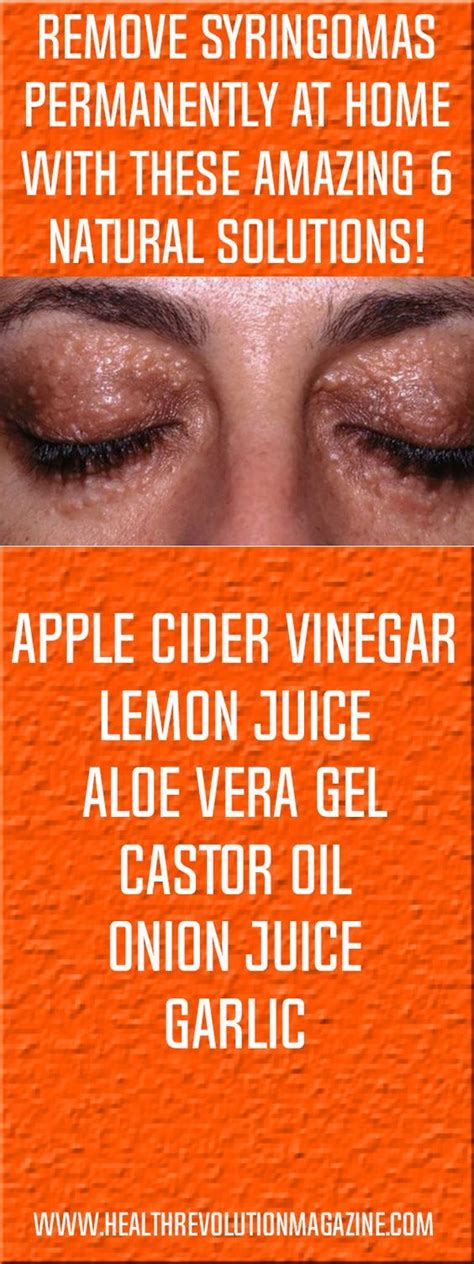 Apple Cider Vinegar For Syringoma Captions For Pictures