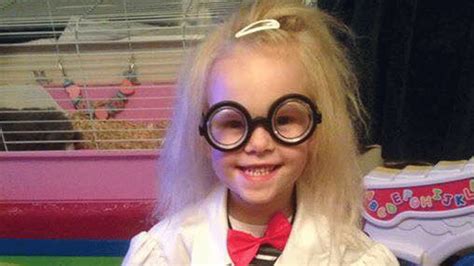 Uncombable Hair Is A Real Syndrome And This Little Girl Suffers From