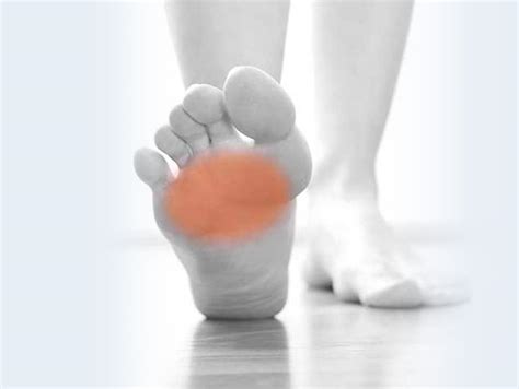 Ball Of Foot Pain Or Metatarsalgia Insoles Metatarsal Orthotics