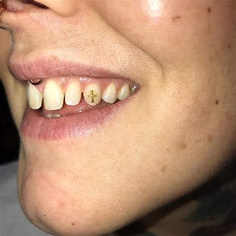 Pin By Westminster Tattoo Company On Tooth Gems Diamond Teeth Tooth