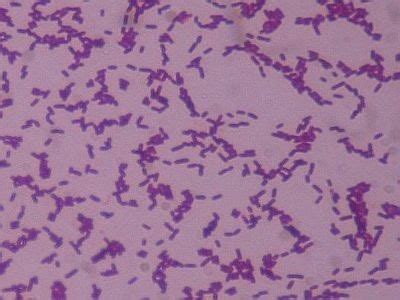 Gram staining was devised by the danish physician, hans christian gram, while working in berlin in 1883. Bug Blog: Lab 2: CNS infections and CSF
