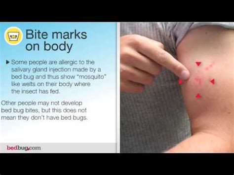 Bed bugs may get attached to your clothes or luggage, during your stay in a hotel room or while you travel by public transport or during your visit to a movie theater. Bed Bug Movie - Do I have bed bugs? - YouTube