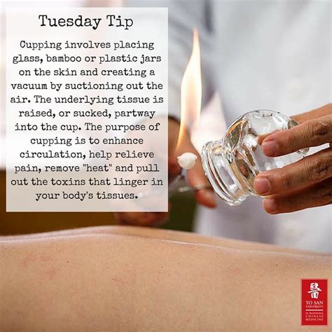 Tuesday Tip Cupping Therapy Has Many Benefits And Can Treat Many