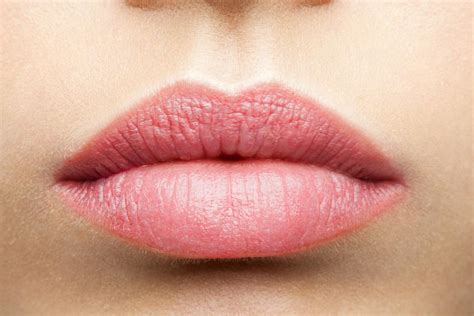 Actinic Cheilitis Causes Treatment And Prevention