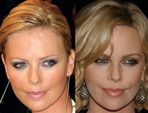 Charlize Theron Nose Job Plastic Surgery Before And After Celebie