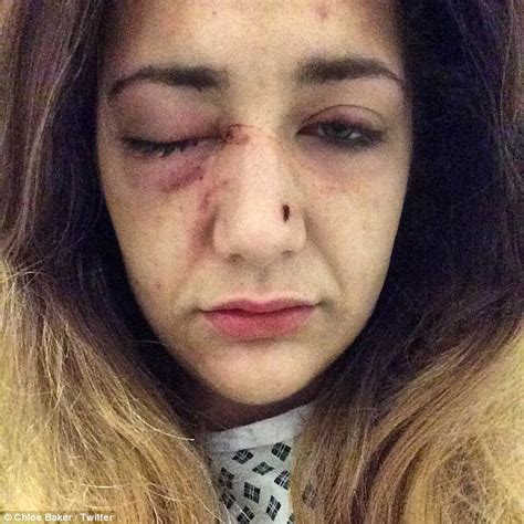 X Factors Chloe Baker Reveals She Was Dragged Off The Streets Into A