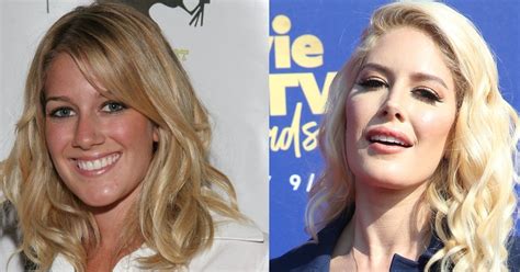Heidi Montag S Plastic Surgery A Look At Her Before And After Photos