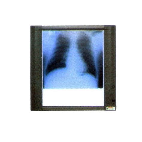 X Ray Screening System Manufacturers Suppliers And Exporters