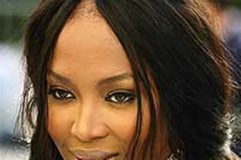 Is Supermodel Naomi Campbell Suffering From Hair Loss Mirror Online