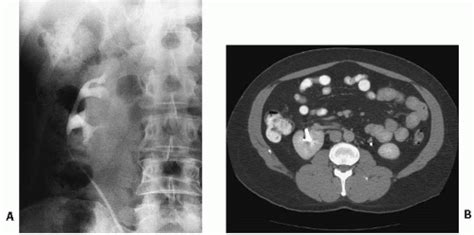 Congenital Anomalies Radiology Key