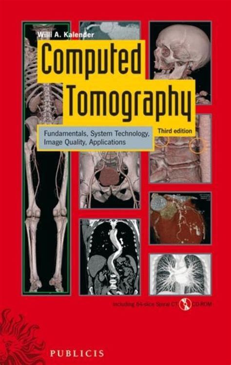 Today helical computerized tomography has. bol.com | Computed Tomography | 9783895783173 | Willi A ...