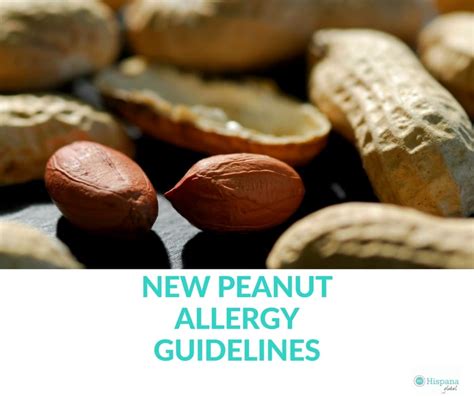 What You Need To Know About New Peanut Allergy Guidelines Hispana Global