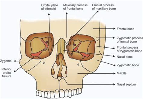 Zygomatic Bone Maxillary Process