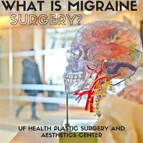 What Is Migraine Surgery Uf Health