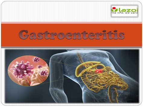 Ppt Gastroenteritis Powerpoint Presentation Free Download Id7433876