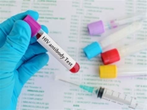Antibody Suppresses Hiv In Infected Individuals Heersink School Of Medicine News Uab