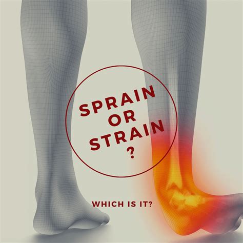 Sprain Or Strain Which Is It MD First Primary Urgent Care