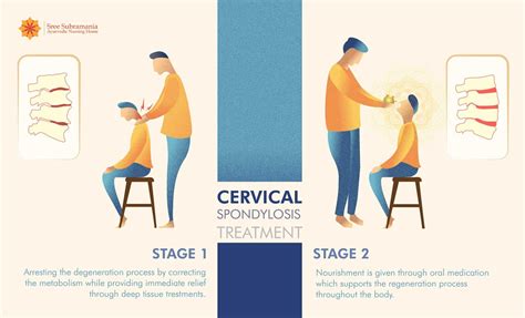 Cervical Spondylosis Treatment Best Treatment For Cervical Pain In Kerala