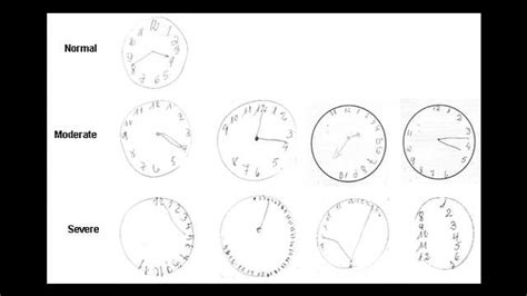 July 31st marks harry potter's birthday Fun Sources: Draw A Clock Test