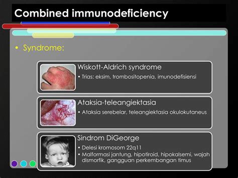 Ppt Immunodeficiency Powerpoint Presentation Free Download Id4339357