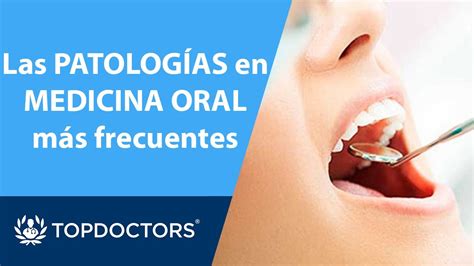 Odontolog A Las Patolog Asen Medicina Oral M S Frecuentes Top