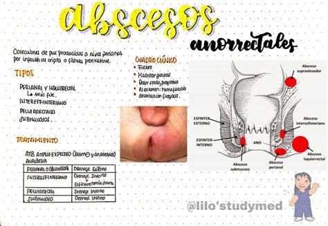 Abscesos Anorrectales Lilostudymed UDocz