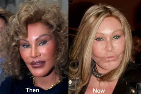 What Jocelyn Wildenstein Looked Like Before Plastic Surgery