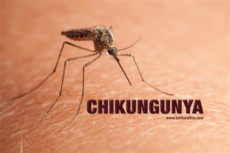 Chikungunya Boletín Informativo 2 Informativo De Salud Crc