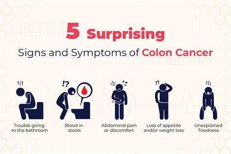 Colon Cancer What Are The Risk Factors Symptoms Prevention