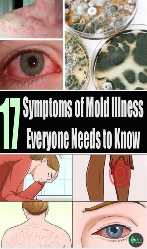 17 Symptoms Mold Illness Everyone Needs Know Symptoms Of Mold Mom Health Health Guide