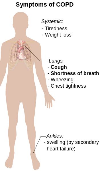 Chronic Obstructive Pulmonary Disease Copd Overview