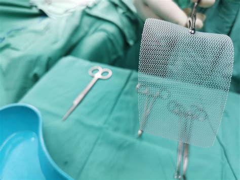 Mdl May Be On The Horizon For Hernia Mesh Lawsuits