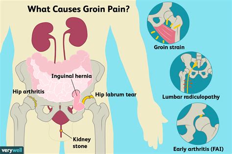 Groin Pain Causes And Treatment