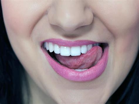 Home Remedies To Clean White Tongue