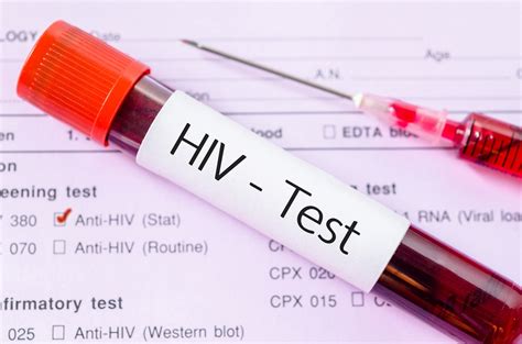 First Time Hiv Testing Low Among Men Who Have Sex With Men Infectious Disease Advisor
