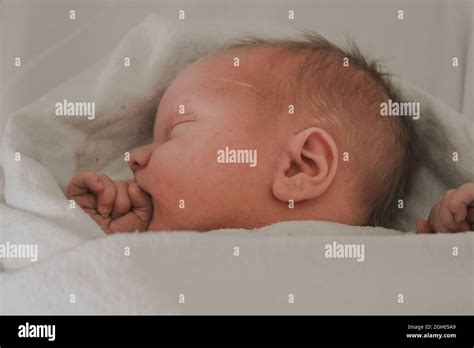 Newborn Baby With Blood Vessels Visible On Face Due To Fast Birth Stock