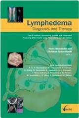 Lymphedema Management The Comprehensive Guide For Practitioners Pictures
