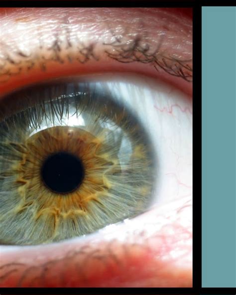 Rarest Eye Color In Humans Owlcation Education