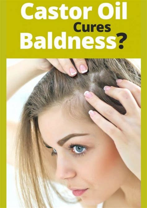An increasingly common hair loss pattern in older women is a receding hairline (frontal fibrosing alopecia). Is Castor Oil Helpful To Treat Baldness? | Thick hair ...