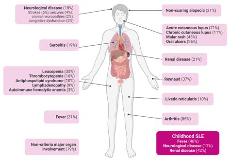 Clinical Considerations In The Diagnosis And Management Of Systemic Lupus Erythematosus