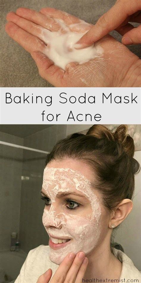 Baking Soda Mask For Acne Prevents Breakouts And Fights Acne Acne