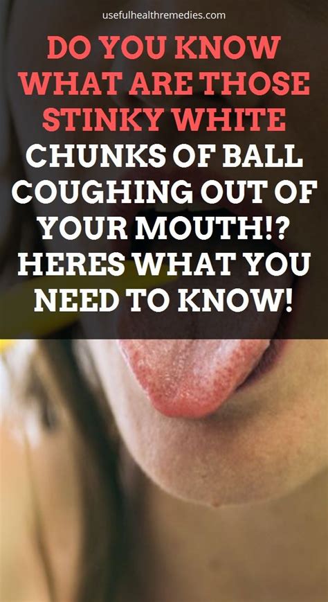 do you know what are those stinky white chunks of ball coughing out of your mouth here s what