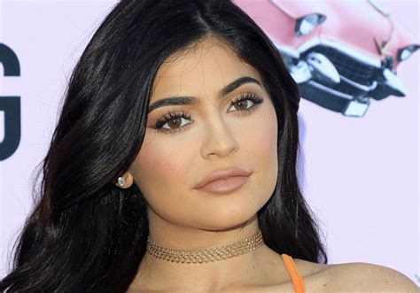 Kylie Jenner Now Inspiring Lip Filler Removal Rostami Opc