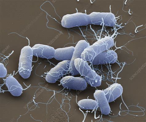 Proteus Mirabilis Bacteria Sem Stock Image C0459735 Science