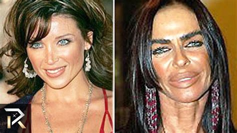 Plastic Surgery Cases That Went Too Far Bad Celebrity Plastic