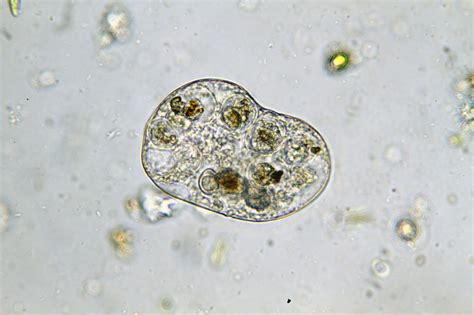 Types Of Protists Biology Wise